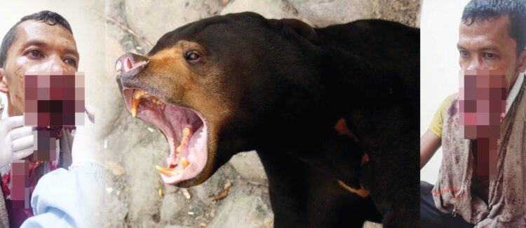 LUKA PARAH— Korban JA (38) warga Kabun, Sumpur Kudus mengalami luka parah akibat diserang beruang di dalam hutan, Rabu (28/4).