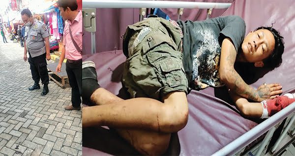 PERAWATAN— DR (28) harus mendapatkan perawatan di rumah sakit usai kalah berduel dengan sesama pengamen di kawasan Pasar Atas, Bukittinggi, Selasa (2/11) dinihari. Sementara itu usai kejadian darah korban terlihat berceceran di lokasi.