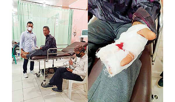 TUKANG OJEK DIBEGAL— Korban G (49) mengalami luka bacok pada tangannya usai melawan dua pelaku begal yang merampas sepeda motornya.