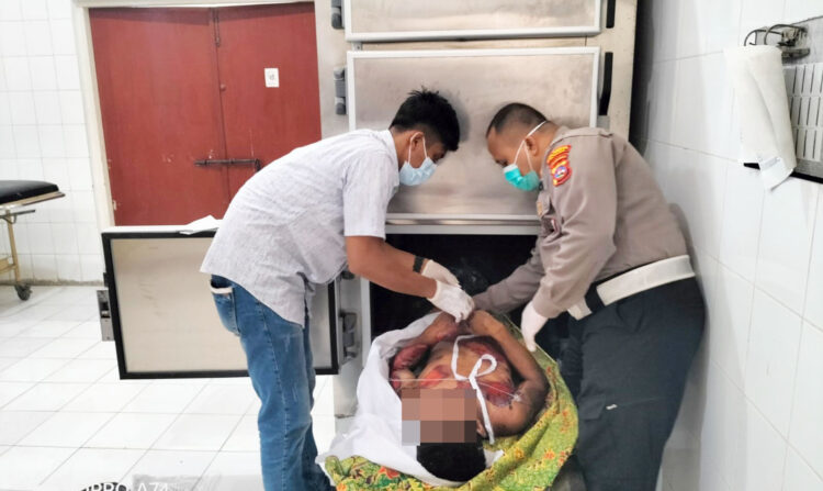 Mayat Mr X Korban Kecelakaan Disimpan di RSUP M Djamil, Ciri-cirinya Bertato Batik di Lengan Kanan 1 DISIMPAN— Mayat tanpa identitas yang merupakan korban kecelakaan disimpan di suang Instalasi Forensik dan Pemulasaraan Jenazah RSUP M Djamil Padang.