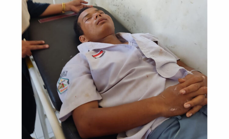 DIKEROYOK— Korban Adinul Haqiqi (16), siswa SMAN 1 Air Bangis mendapatkan perawatan usai dikeroyok.