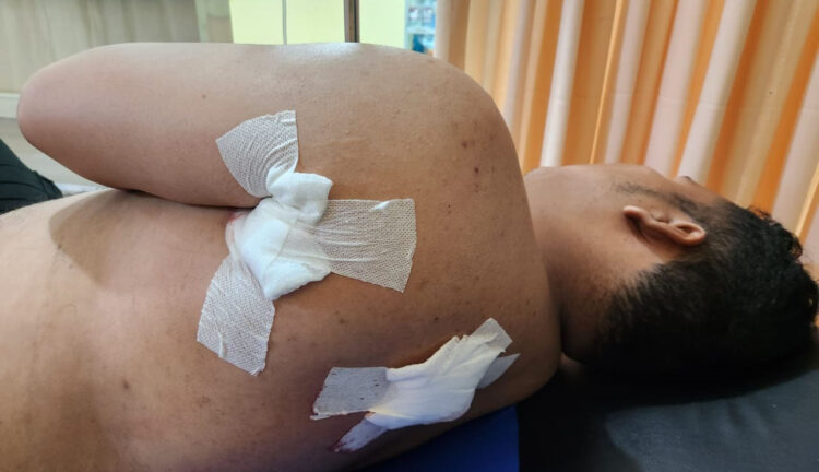 Tragis! Polisi Berpangkat Bripda Ditikam Pemabuk, Korban Berusaha Melerai Keributan, Pelaku Babak Belur Dihajar Massa 1 DITIKAM— Korban Bripda Mu’ammad Jimly dirawat di RS Bhayangkara Polda Sumbar usai ditikam oleh pria mabuk.