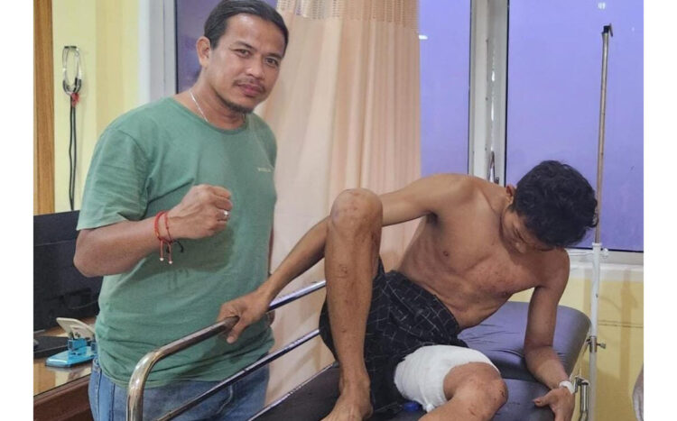 BOBOL RUMAH— Pelaku Fajar Akbar (18) yang merupakan spesialis bobol rumah dirawat di RS Bhayangkara Padang usai ditembak Tim Klewang Polresta Padang.