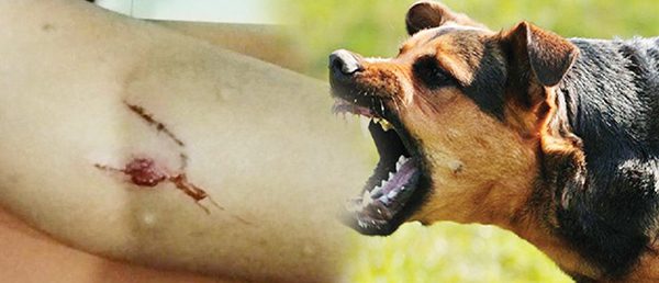 4 Anak-anak dan 2 Dewasa Digigit Anjing Rabies, Distan: Korban Digigit Dibagian Tumit, Betis, Paha 1 ilustrasi gigitan anjing