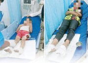 Ngeri! Gas Meledak, Satu Keluarga Disambar Api, Lima Orang Alami Luka Bakar dan Dirawat di RS, Diduga Gegara Kebocoran pada Instalasi Kompor