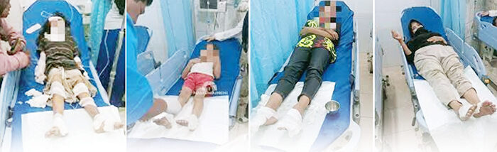 Ngeri! Gas Meledak, Satu Keluarga Disambar Api, Lima Orang Alami Luka Bakar dan Dirawat di RS, Diduga Gegara Kebocoran pada Instalasi Kompor 1 02 Gas Meledak