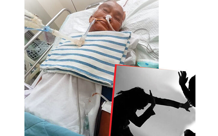 02 Wanita Lansia Kritis Dianiaya