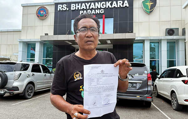 Dugaan Penganiayaan oleh Petugas Saat Razia, Pengelola Kafe Padi Boneh Polisikan Dubalang dan Satpol PP Padang 1 TUNJUKAN BUKTI LAPORAN— Novrianto usai melapor dugaan tindak penganiayaan terhadap dirinya ke Polresta Padang dan visum di RS, Bhayangkara Padang, Selasa (9/12).