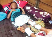 Mandi di Pantai Air Manis, Bocah 7 Tahun Diserang Buaya