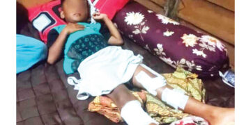 Mandi di Pantai Air Manis, Bocah 7 Tahun Diserang Buaya