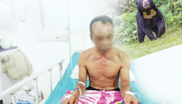 Lindungi Anak, Ayah Luka Parah Diserang Beruang, Korban Perjalanan Pulang usai Panen Manggis, Kening hingga Mulut Robek Terkena Cakar